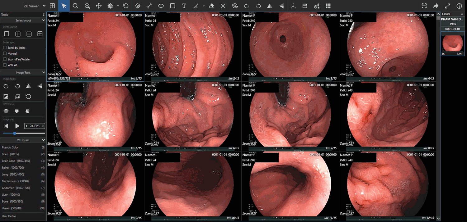 AI-assisted medical imaging