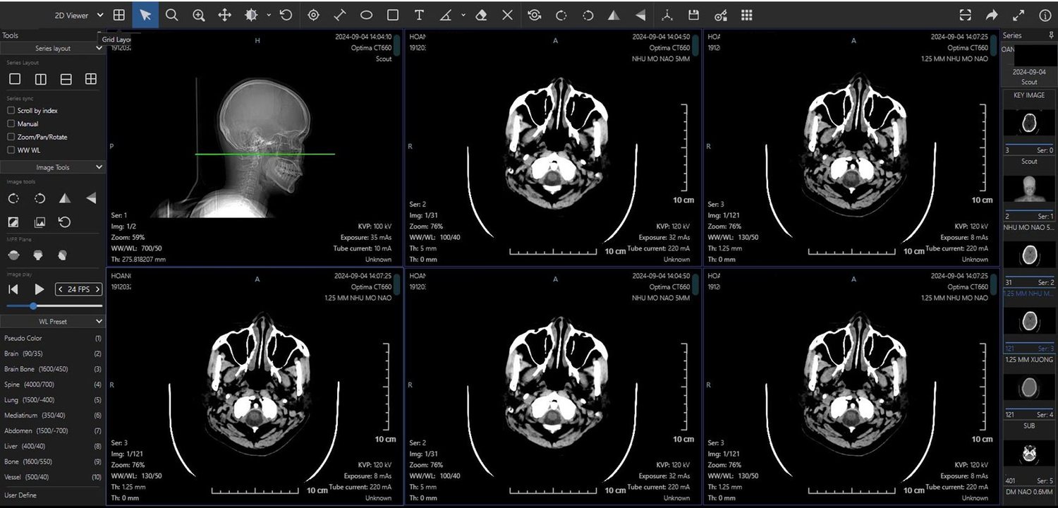 Smart Hospital imaging viewer