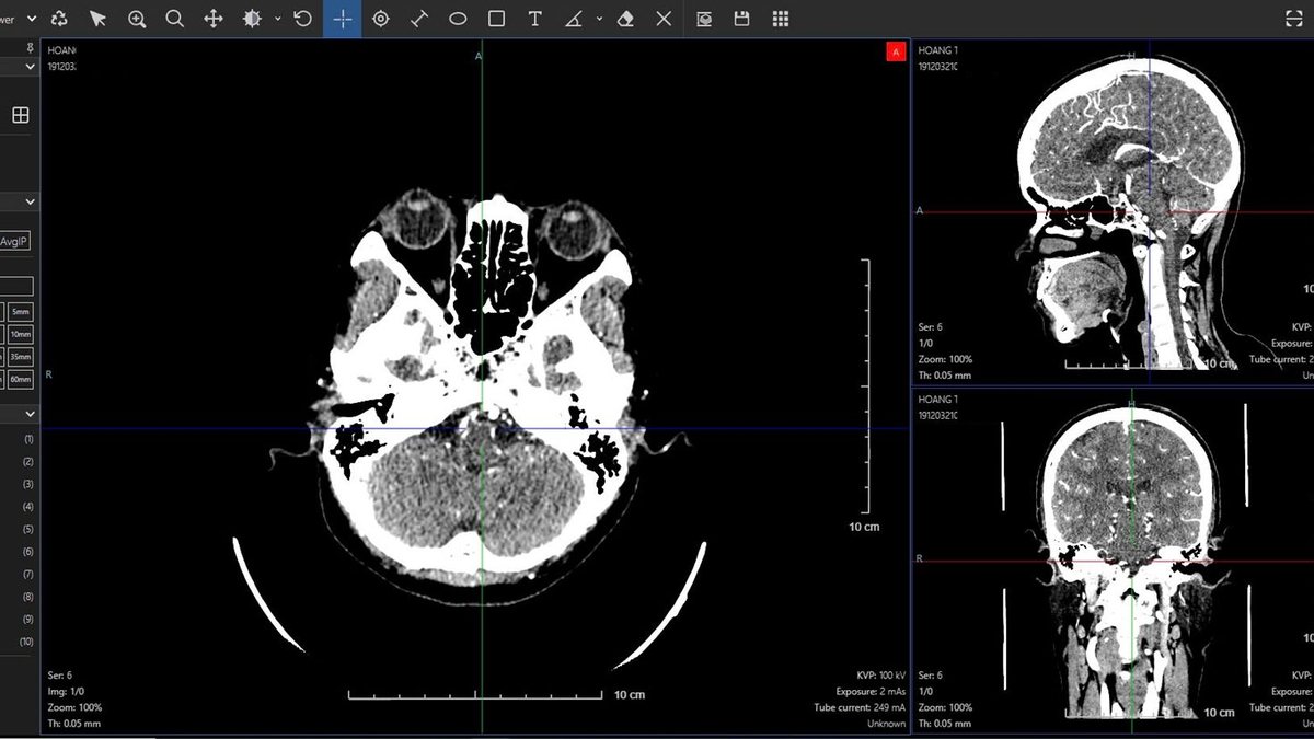 PACS imaging workstation — CT viewer
